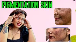 How To Treat Pigmentation At Home Skin Care Routine In Hindi  Pigmentation Skin 2024 Nisha Lambha [upl. by Nageet]