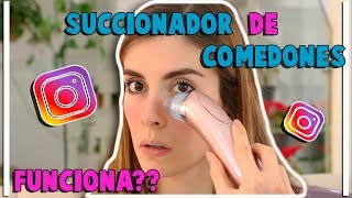 Instagram me hizo probarlo  Máquina limpiadora de poros y exfoliación  Funciona  Laura Fest ★ [upl. by Bezanson73]