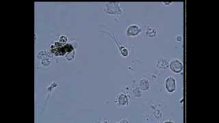 Semen sperm under the microscope Сперма под микроскопом [upl. by Klemm]