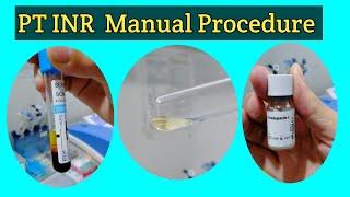 PT INR Manual Procedure Prothrombin Time Test PT Manual Test PT Manual Procedure in Urdu amp Hindi [upl. by Ahsikrats180]