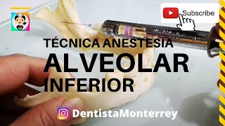 💉TÉCNICA ANESTESIA ALVEOLAR INFERIOR👅 PASO A PASO [upl. by Eustatius]