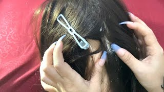 ASMR Fast Aggressive Scratching Scalp and Dandruff Removal [upl. by Lenrad138]