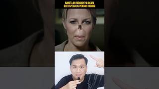 HIDUNG WANITA INI DICURI OLEH SEPESIALIS PENCURI HIDUNG‼️shorts alurcerita storytelling [upl. by Mccreary521]