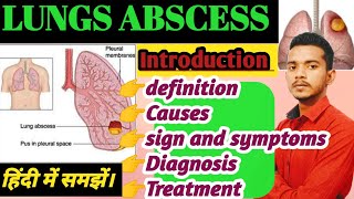 LUNGS ABSCESS DISEASE  Lung abscess disease in hindi  singn and symptoms of lungs abscess [upl. by Shaer815]