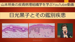 日光黒子とその病理組織学的鑑別疾患 dermatopathology 山本明美 lentigo [upl. by Currie]