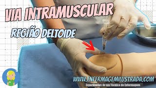 Administração INTRAMUSCULAR em Região DELTOIDE [upl. by Hurlow410]