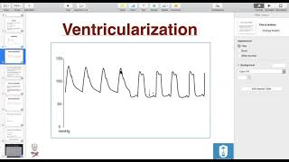 Hemodynamics Dr Waleed Alharbi [upl. by Modestine]