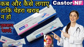 Castor NF skin cream How to use castor nf skin creamCastor NF Skin Cream Uses Or Side Effects [upl. by Phia]