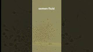 Semen fluid examination [upl. by Joye]