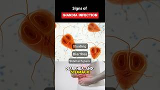 IBS Symptoms or Giardia Parasite Infection guthealth youtubeshorts shorts [upl. by Onairotciv190]