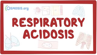 Respiratory acidosis  causes symptoms diagnosis treatment pathology [upl. by Leiahtan]