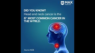 Head amp Neck Cancer Symptoms Prevention and Treatment  Max healthcare [upl. by Allesiram]