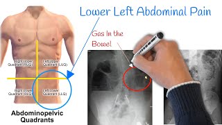 Pain in lower left abdomen  Low Stomach Pain Most Common Causes [upl. by Larrie]