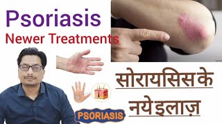 सोरायसिस के नये इलाज़  Psoriasis Newer Treatments  Tofacitinib  Infliximab  Adalimumab psoriasis [upl. by Eisele]