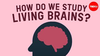 How do we safely study living brains  John Borghi and Elizabeth Waters [upl. by Llenrep347]