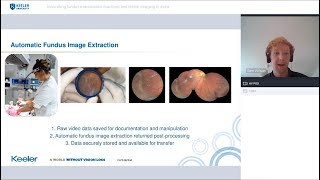 MIO Webinar Exam Practices amp Retinal Imaging in India [upl. by Mecke]