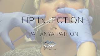 Lip Injection  MPS MedSpa [upl. by Aremaj]