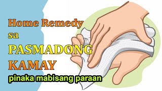 HOME REMEDY SA PASMADONG KAMAY  HERBAL  HALAMANG GAMOT  LUNAS SANHI TIPS PAANO MAWALA [upl. by Marduk580]