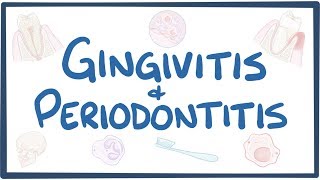 Gingivitis and periodontitis  causes symptoms diagnosis treatment pathology [upl. by Audrie]