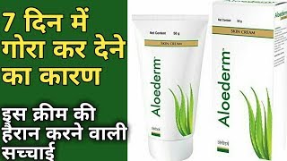 Gora Hone Ki Best Cream Aloederm Skin Cream  Aloederm Skin Cream Use In Hindi  Aloederm Skin Cream [upl. by Nisior]