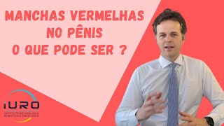 Manchas Vermelhas no Pênis  O que pode ser [upl. by Heer]