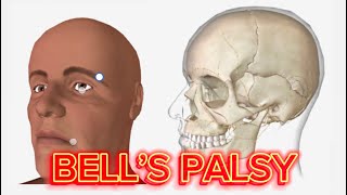 Bells Palsy Understanding Symptoms Causes amp Recovery  Facial Nerve Paralysis Explained [upl. by Abrahan]