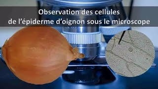 CELLULES DOIGNON AU MICROSCOPE [upl. by Atinahc]