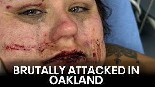 Oakland woman brutally attacked by group of young people  KTVU [upl. by Pratte338]