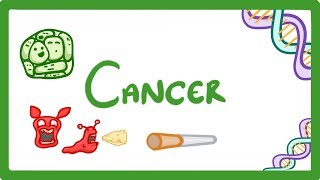 GCSE Biology  What is Cancer Benign and Malignant Tumours Explained 43 [upl. by Necyla]