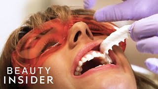 The Fastest Way Dentists Whiten Teeth  Beauty Explorers  Beauty Insider [upl. by Stambaugh609]