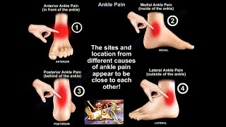 Ankle Pain  Everything You Need To Know  Dr Nabil Ebraheim [upl. by Casady334]