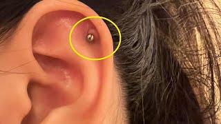 how to get rid of piercing bumps on ear fast and easy [upl. by Aralk437]