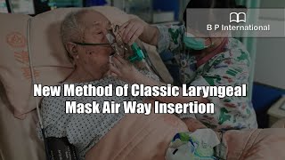 New Method of Classic Laryngeal Mask Air Way Insertion [upl. by Ambrogino]