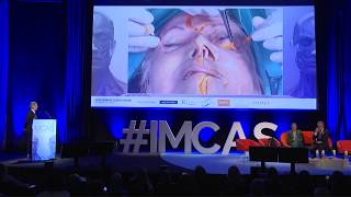 IMCAS Americas 2019  A Whole New Learning Experience [upl. by Cita342]