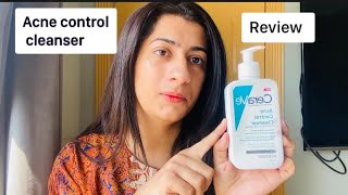 CeraVe Acne Control Cleanser Review [upl. by Aggappora23]