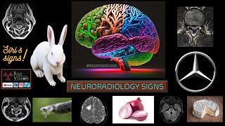 NEURORADIOLOGY SIGNS [upl. by Anirpas627]