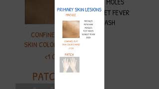 SKIN LESIONS Macule vs Patch [upl. by Atiuqihc203]