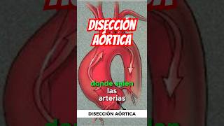 Disección aórtica 🫀 emergency doctor [upl. by Snave]