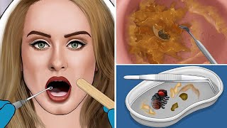 ASMR Remove The Fly amp Tonsil Stone From Throat [upl. by Helmer]