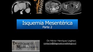 Isquemia Mesentérica Parte 2 [upl. by Naibaf447]