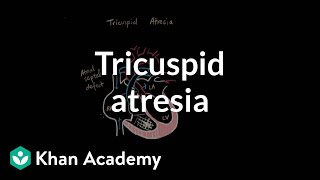 Tricuspid atresia  Circulatory System and Disease  NCLEXRN  Khan Academy [upl. by Aiam]