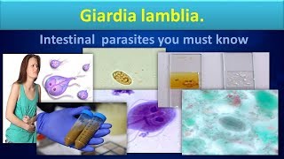 Giardia lambliaLife cycleStructureLabdiagnosisGiardiasisClear overview [upl. by Sexela]