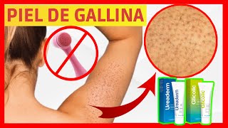 PELIGRO 🐔 CÓMO ELIMINAR LA PIEL DE GALLINA O QUERATOSIS PILAR 🐔 TRATAMIENTO EFECTIVO [upl. by Aropizt]