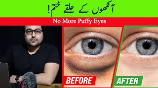 Dr ZeeHow to Get Rid of Puffy Eyes and Dark Circles  डॉक्टर ज़ी [upl. by Esinrahs]