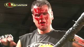 Matt Tremont vs Brain Damage  CZWstudioscom [upl. by Adnahsor805]