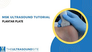 Musculoskeletal ultrasound of the plantar plate in the foot [upl. by Perce582]