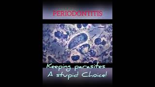 Periodontitis choice biology microscope Trichomonas tenax [upl. by Eedebez]