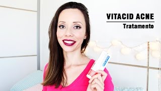 Vitacid Acne  Tratamento Inverno 2015 [upl. by Harraf652]