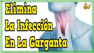 Que Tomar Para El Dolor De Garganta  Elimina La Infeccion En La Garganta [upl. by Ainnos]