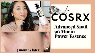 COSRX SNAIL MUCIN ESSENCE MUST WATCH BEFORE YOU BUY  REVIEW  DEMO ON COMBINATION SKIN [upl. by Pitarys]